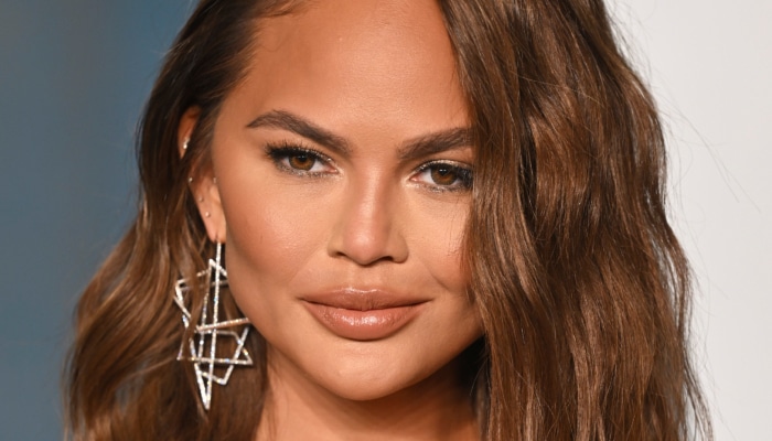 Kinnfettreduksjon trender blant kjendisene - og øker i popularitet i Norge. Her Chrissy Teigen.